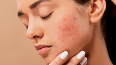 Effective acne and pimple care products in India